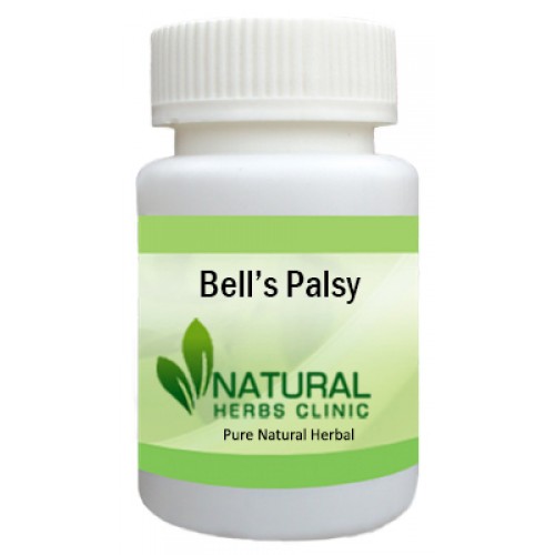Herbal Treatment for Bell’s Palsy
